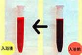 Blood samples