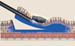 ESD Diagram 3