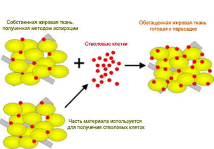 Lipotransfer