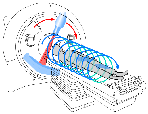 tomotherapy